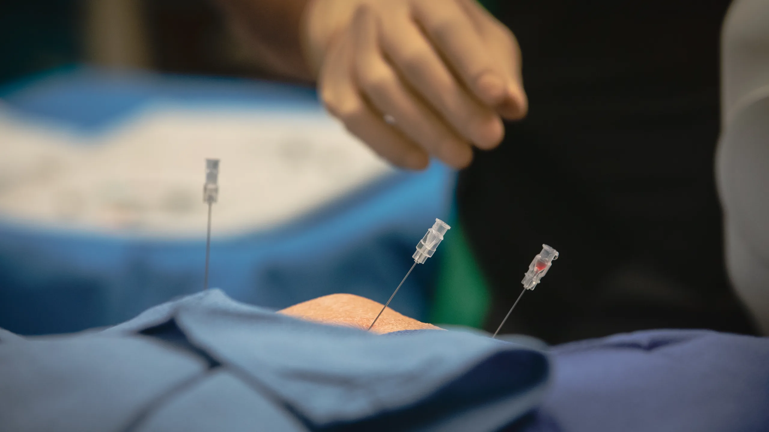 Image-guided spinal injection being performed